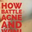 How To Battle Acne And Win—Sneaky Tricks The Enemy Pulls