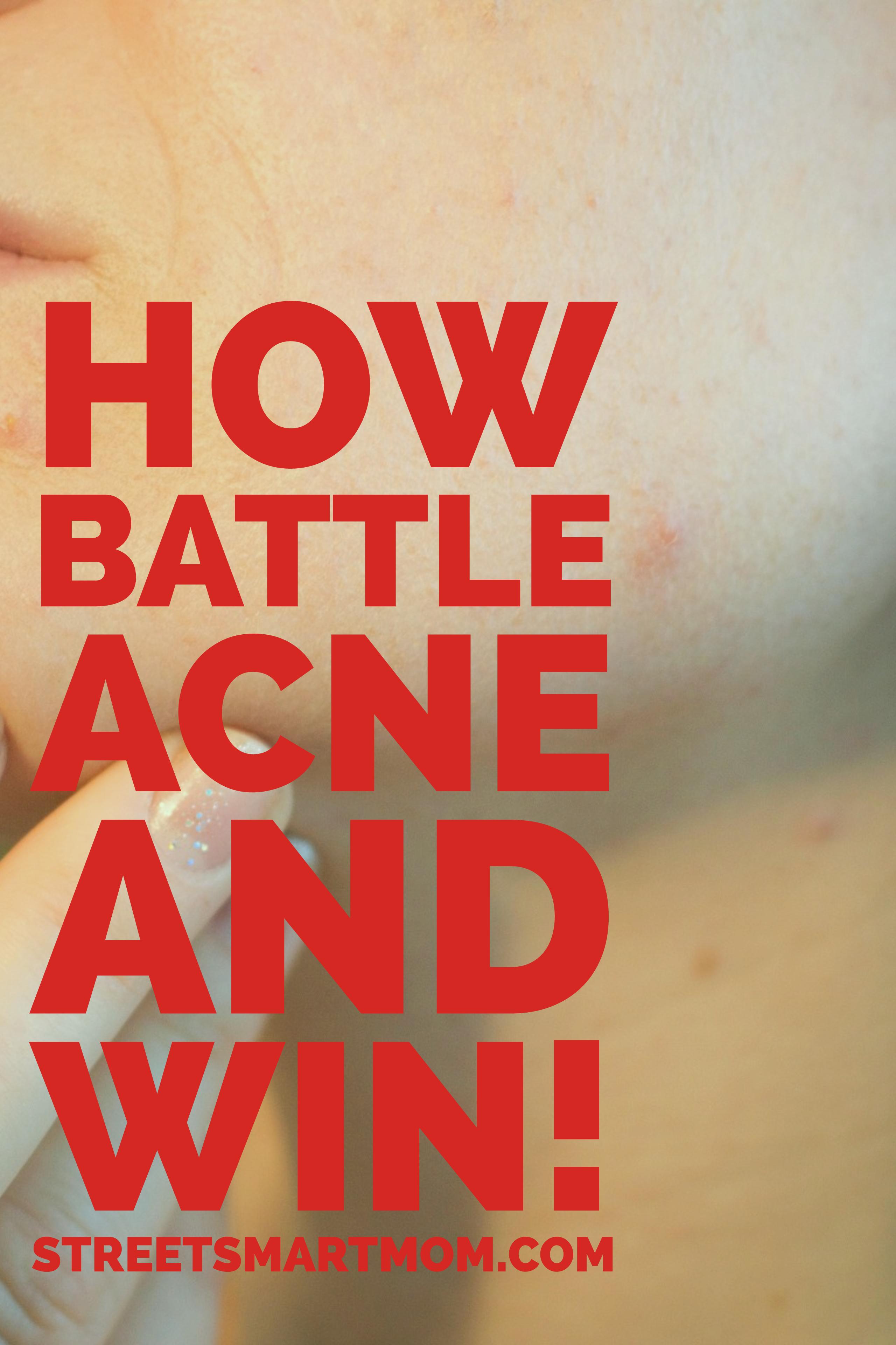 how to battle acne and win